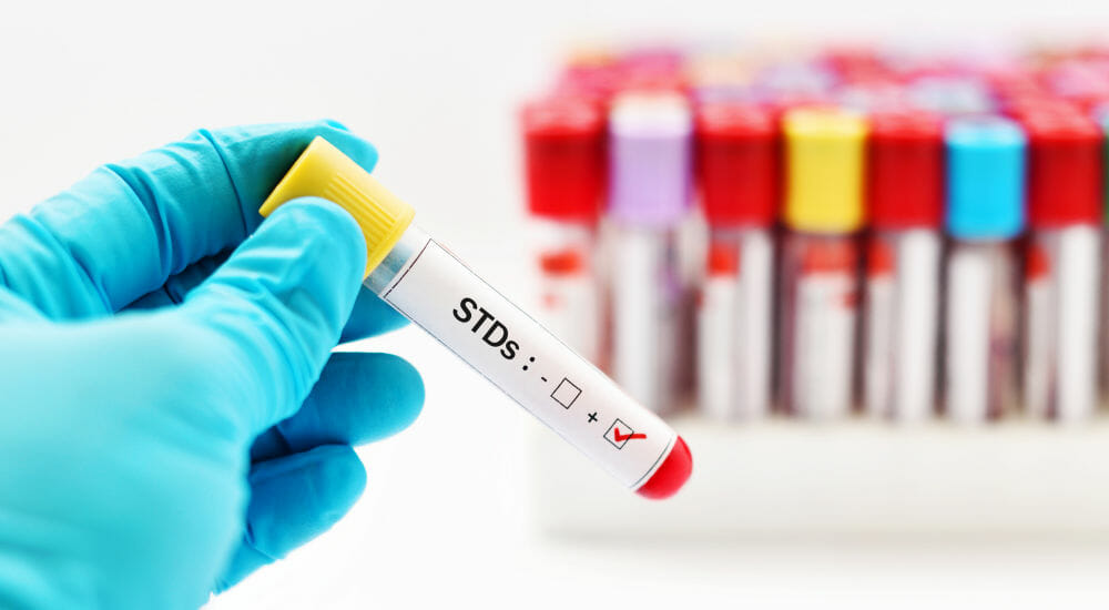 STD Testing In Grand Junction, CO